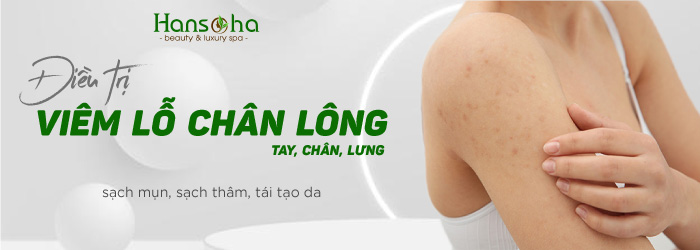 4. Quy trình chăm sóc da hàng ngày cho da mụn và lỗ chân lông to